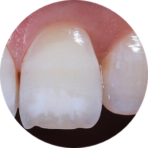 icon-vestibular_vorher